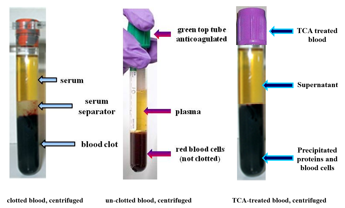 The Importance of Serum Tests for Dental Implants | DentalEHub.com