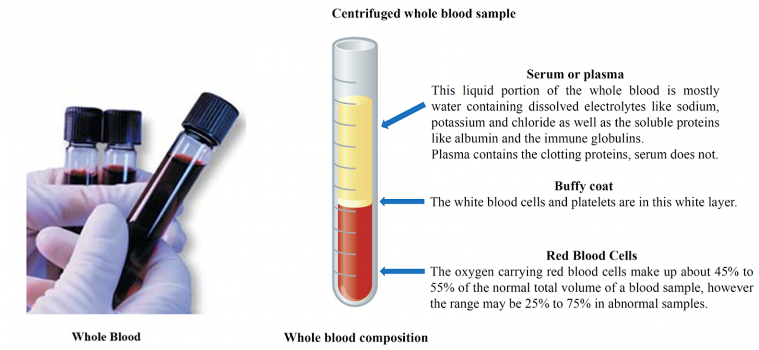 Stefan Rose, M.D. Compares Different Blood Ethanol Tests For Accuracy